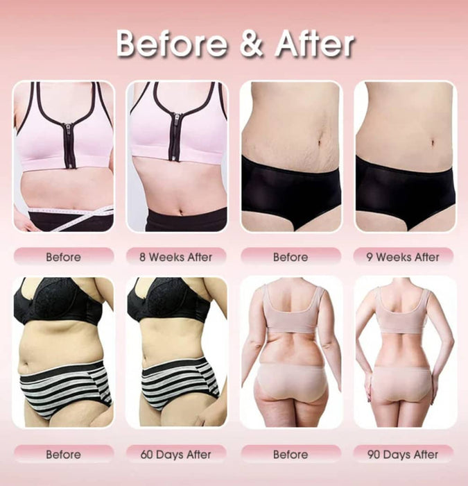 3 In 1 Cavitation Machine 40K Ultrasonic Fat Burning Radio Frequency RF Body Sculpture