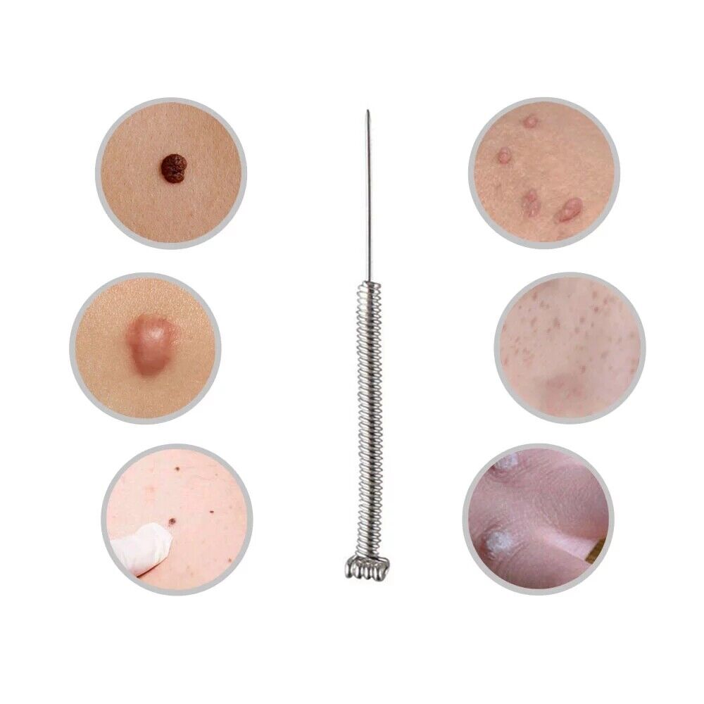 Hair Removal Treatments