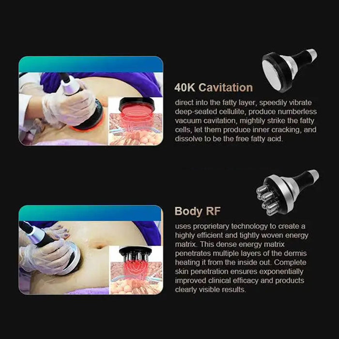 4 IN 1 Fat Freeze Cold Vacuum Cryolipolysis Cryotherapy Weight Loss Slimming Machine Body Sculpting Cavitation RF Machine