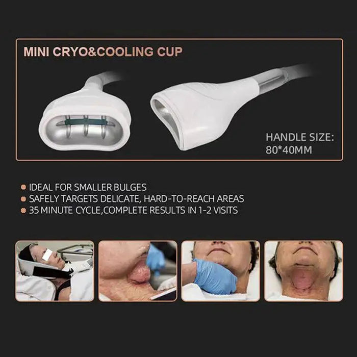 4 IN 1 Fat Freeze Cold Vacuum Cryolipolysis Cryotherapy Weight Loss Slimming Machine Body Sculpting Cavitation RF Machine