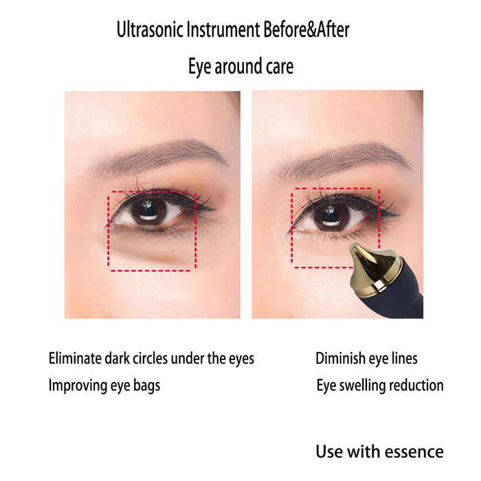 3mhz Ultrasonic Ultrasound Skin Care Wrinkel Remove Eye's Care Body Massage Stretch Marks Remove Machine